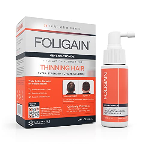 30 meilleurs Minoxidil 5% Homme triés sur le volet pour vous
