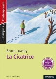 30 meilleurs La Cicatrice De Bruce Lowery triés sur le volet pour vous